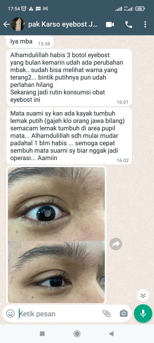 testi-katarak-1-1.jpg